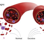 como sanar niveles altos de glucosa en sangre con la varita SPV