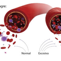 como sanar niveles altos de glucosa en sangre con la varita SPV