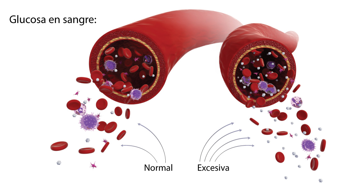 como sanar niveles altos de glucosa en sangre con la varita SPV