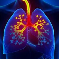pulmones-asma-bronquitis