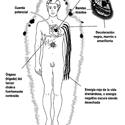 aura afeccion cardiaca